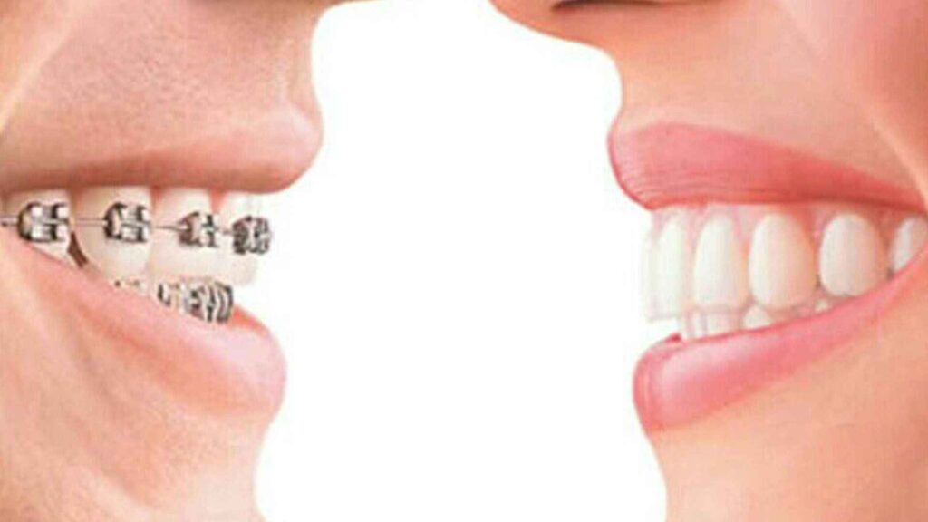 Perawatan orthodonti