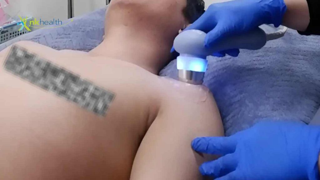 Pengobatan Frozen Shoulder