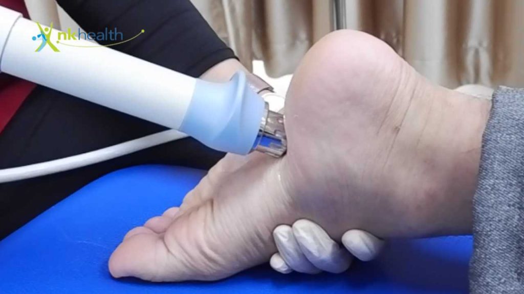 Fisioterapi Plantar Fasciitis di Bekasi