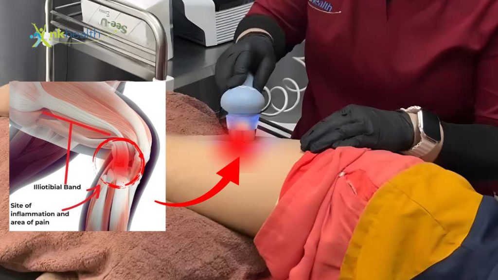 Apakah Iliotibial Band Syndrome Bisa Sembuh