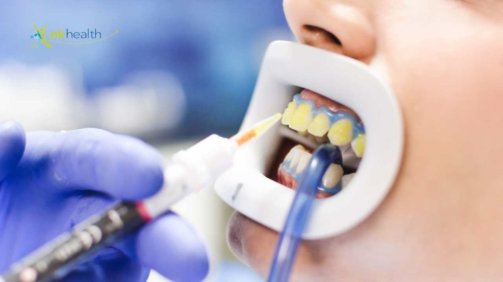 Bleaching Gigi Jakarta Terdekat