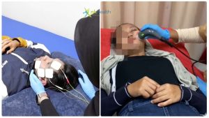 Pengobatan Bell's Palsy Bekasi