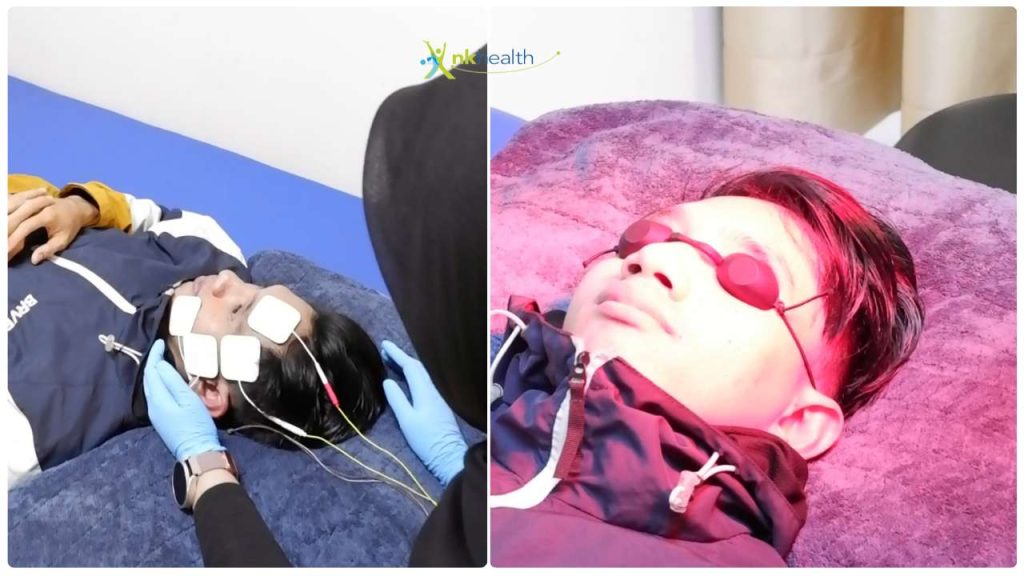 pengobatan bell's palsy yang sudah lama