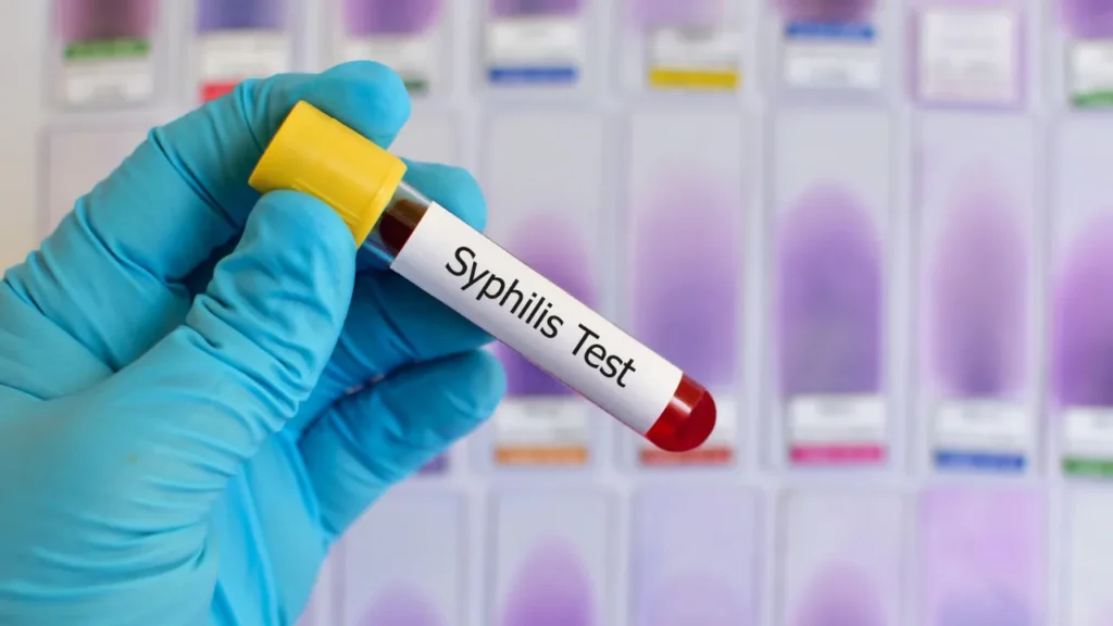 Apakah Sifilis Bisa Sembuh?