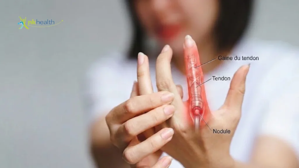 Penyebab Jari Tangan Kaku Saat Kamu Bangun Tidur