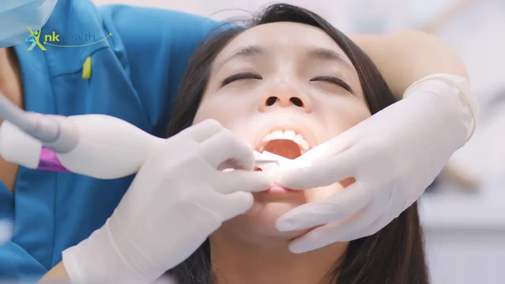 Scaling Gigi Berapa Bulan Sekali