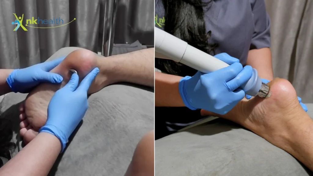 fisioterapi plantar fasciitis