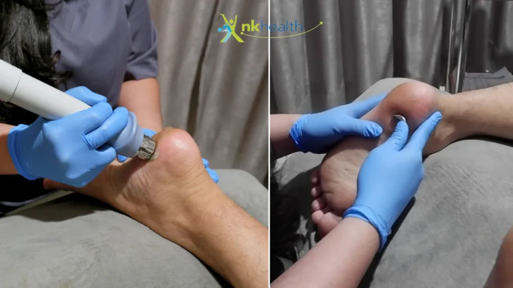 Klinik Fisioterapi Plantar Fasciitis Terbaik